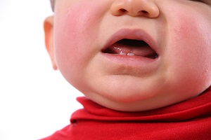 Teething rash: to help your baby Baby & toddler articles & support | NCT