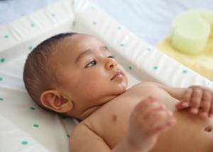 baby circumcision pictures