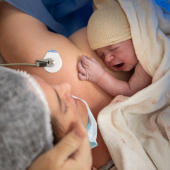 Caesarean birth