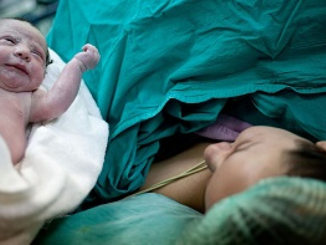 Being born by Caesarian section may affect your intelligence